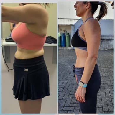 Renata — antes e depois